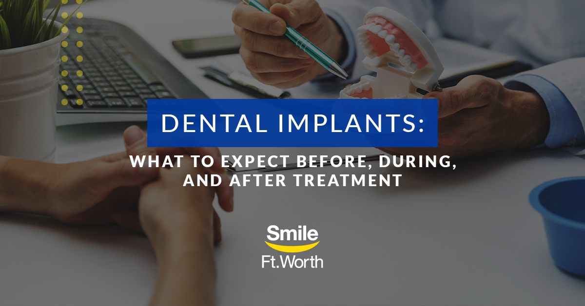 Dental Implants: What to Expect | Smile Fort Worth