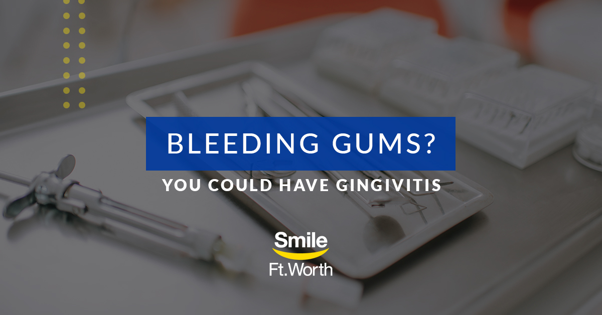 Bleeding Gums? You Could Have Gingivitis | Smile Fort Worth