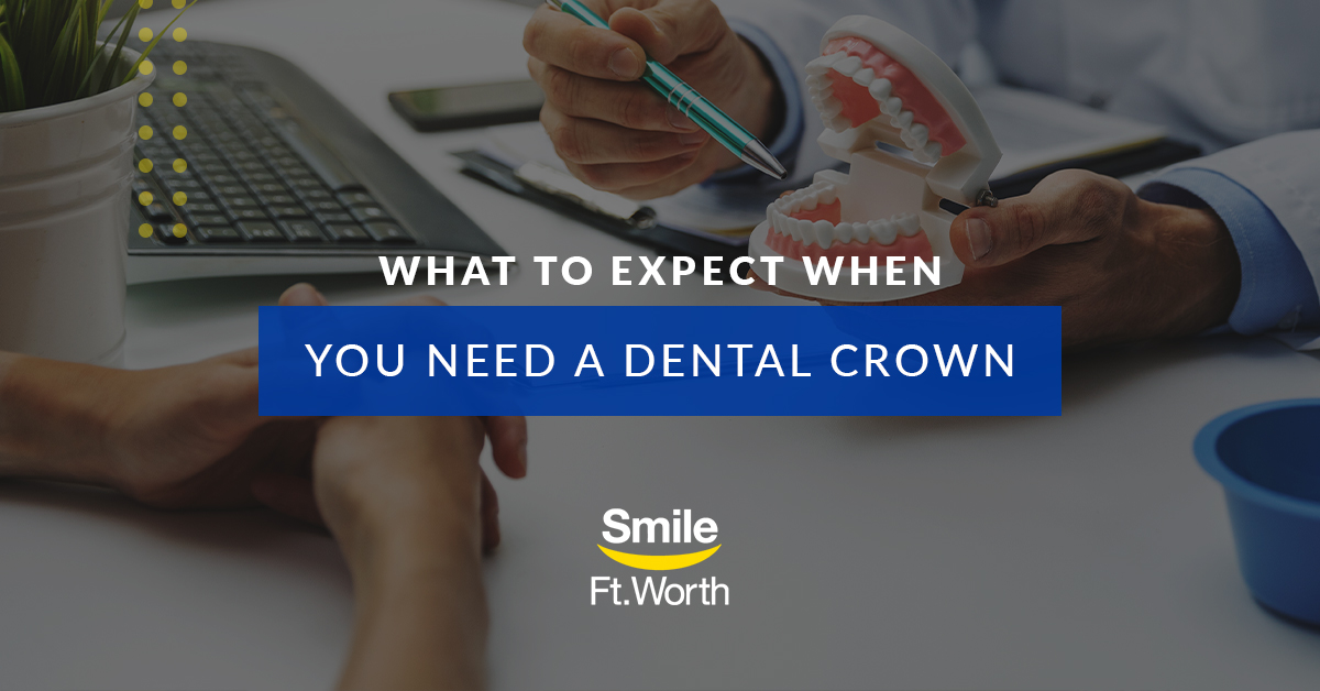 What to Expect When You Need a Dental Crown | Smile Fort Worth | Fort Worth Dentists